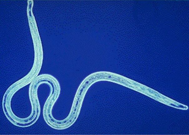 nematodoak giza gorputzean