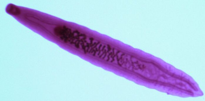 fluke parasitoa giza gorputzetik